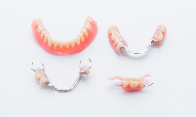 Understanding the restoration options available after a tooth extraction is crucial for maintaining oral health.