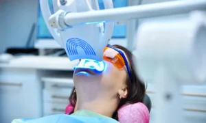 Why Choose Professional Teeth Whitening in Clinton, NC