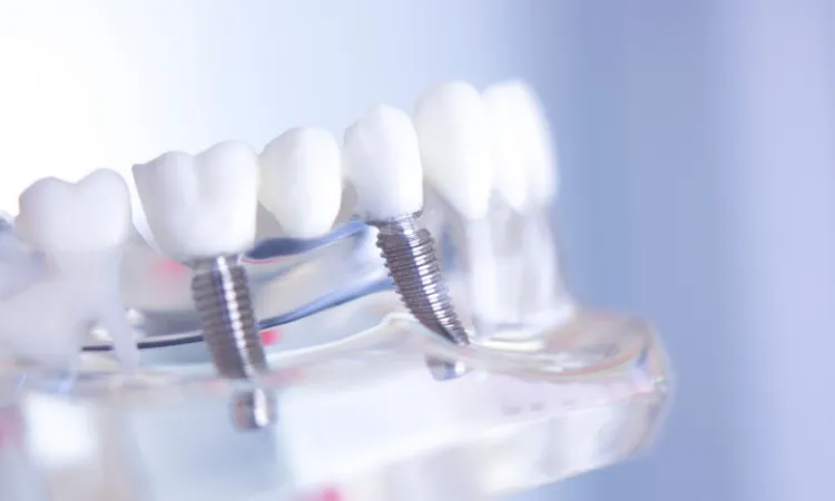 Which Dental Bridge is Right for You? in Clinton, NC